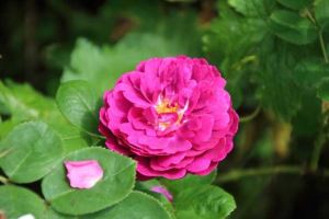 王宝芹整形医生-邢台市王宝芹医生鼻翼缩减手术整形好不好
